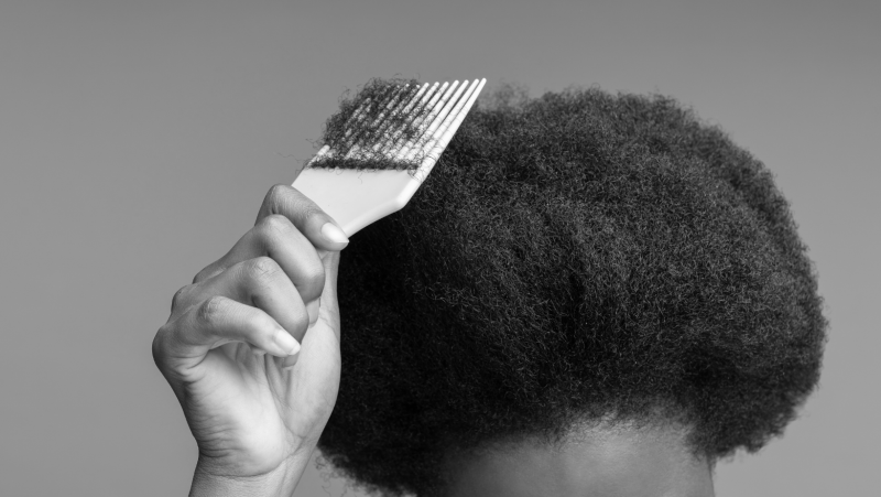 Greffe de Cheveux Afro : la solution pour les cheveux crépus, frisés