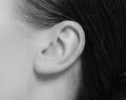lobe oreilles fendus lyon chirurgie réparatrice