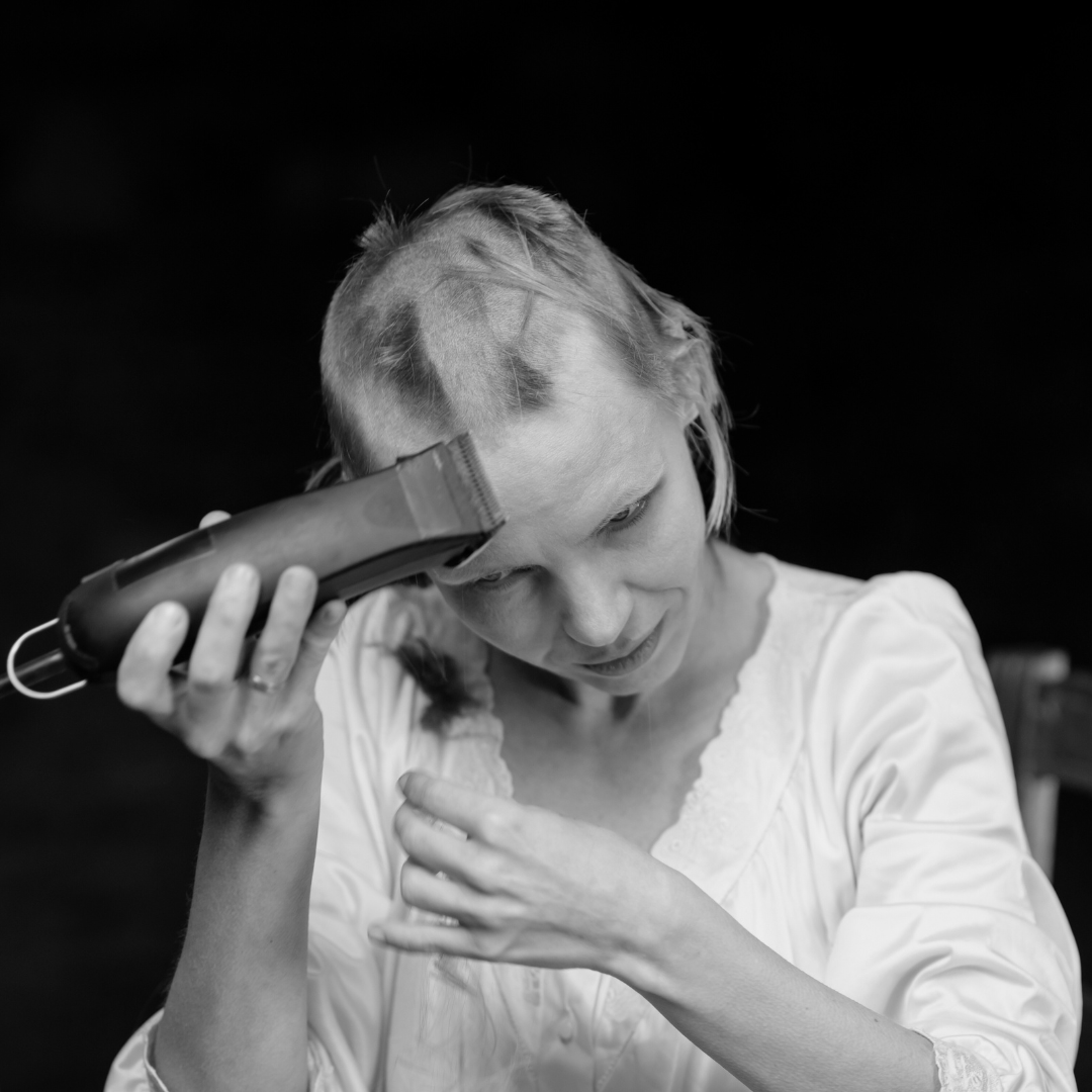 Perte de Cheveux Due à la Chimiothérapie