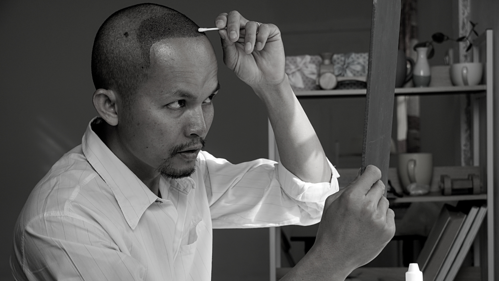 Soin après greffe à Lyon