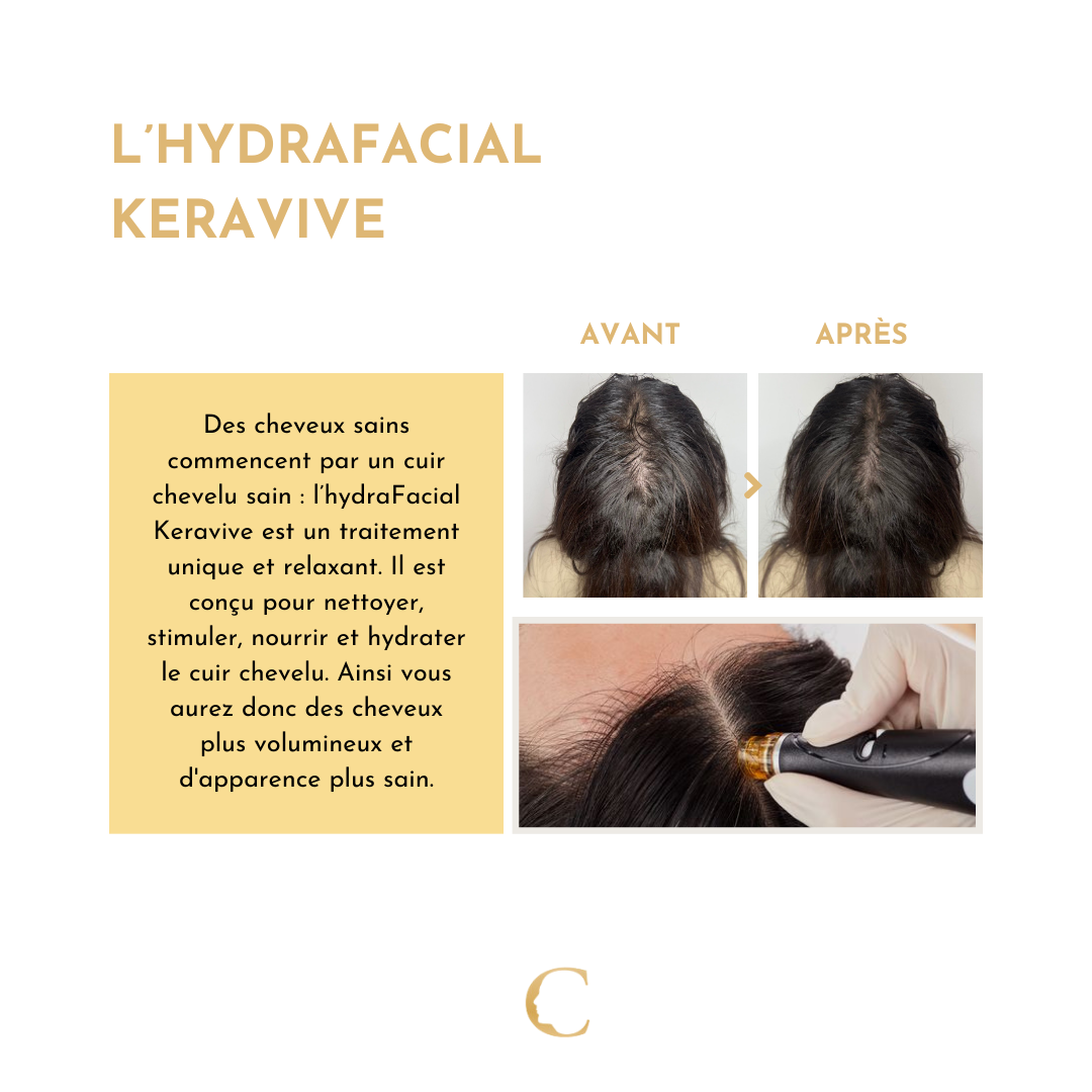 Traitements capillaire Lyon 