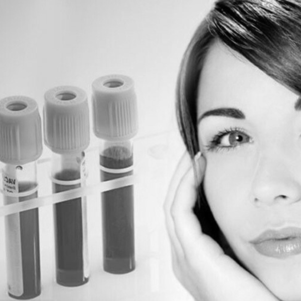 iprf Lyon clinique crillon plasmapherese