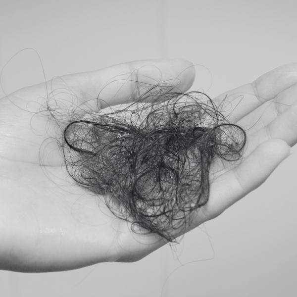 Bilan capillaire proche de Grenoble