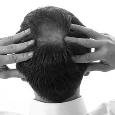 La greffe de cheveux par extractions d'unités folliculaires : la FUE